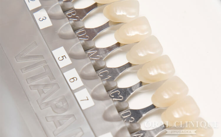 歯の色合わせに使用するシェードガイド