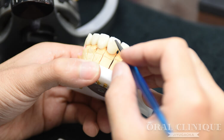 セラミックの色や形を整える歯科技工の工程