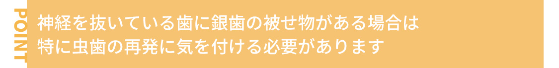 神経を抜いている歯に銀歯の被せ物がある場合は、特に虫歯の再発に気を付ける必要があります