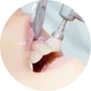 自由が丘 歯医者 審美クリーニング